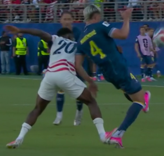 The Unofficial World Cup Thread-ankle-png