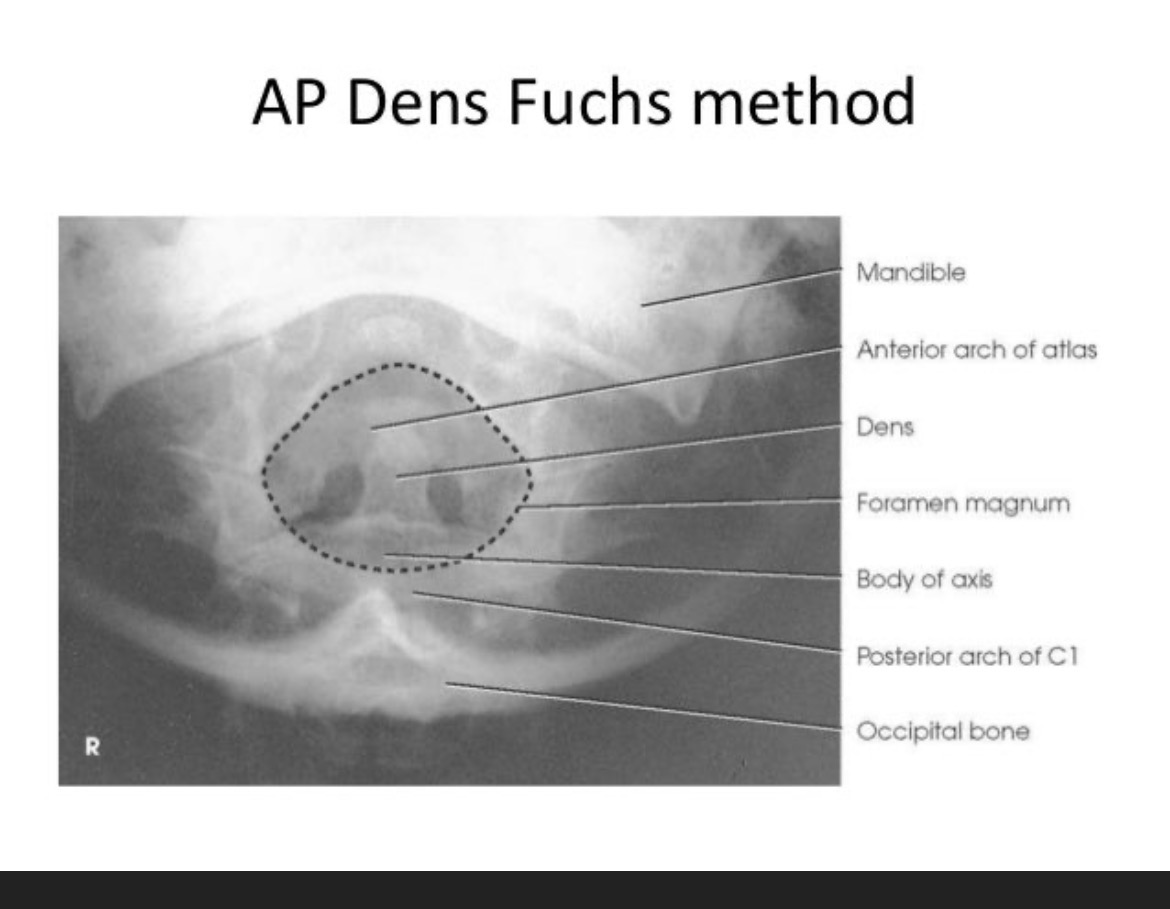 Fuchs vs Henriksen vs Quilter-img_2443-jpeg