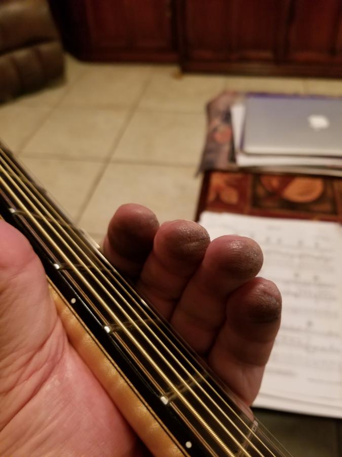 Elferink 14&rdquo;-elferink-fingers-jpg